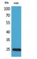 IGFBP6 Polyclonal Antibody