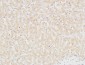 Troponin T-C Polyclonal Antibody