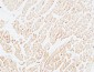 Troponin T-C Polyclonal Antibody