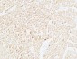 Troponin T-C Polyclonal Antibody