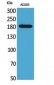 Macroglobulin α-2 Polyclonal Antibody