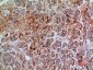 Annexin VII Polyclonal Antibody