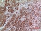 Annexin VII Polyclonal Antibody