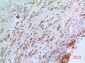 CGREF1 Polyclonal Antibody