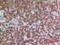 Apaf-1 Polyclonal Antibody