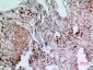 NFATc1 Polyclonal Antibody