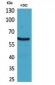 gp91-phox Polyclonal Antibody