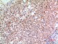 gp91-phox Polyclonal Antibody