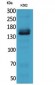 RFC1 Polyclonal Antibody