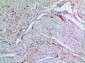 RFC1 Polyclonal Antibody