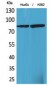 17β-HSD4 Polyclonal Antibody