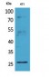 CD81 Polyclonal Antibody