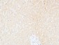 CD166 Polyclonal Antibody