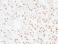 CD166 Polyclonal Antibody