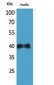 IL-8Rβ Polyclonal Antibody