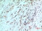 IL-8Rβ Polyclonal Antibody