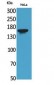 Jagged1 Polyclonal Antibody