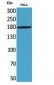 Endo180 Polyclonal Antibody