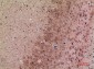 Endo180 Polyclonal Antibody