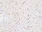 Inhibin β-A Polyclonal Antibody