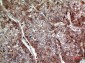 MDA-7 Polyclonal Antibody