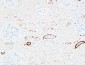 PD-ECGF Polyclonal Antibody