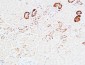 PD-ECGF Polyclonal Antibody