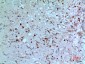 PD-ECGF Polyclonal Antibody