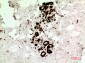 HSP70 Polyclonal Antibody