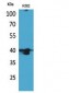 GPR87/95 Polyclonal Antibody