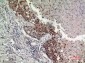 GPR87/95 Polyclonal Antibody