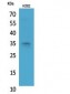 Syntaxin 1 Polyclonal Antibody