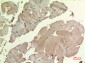 SDHB Polyclonal Antibody