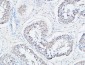 SERCA2 Polyclonal Antibody