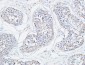 SERCA2 Polyclonal Antibody