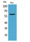 FMO3 Polyclonal Antibody