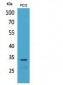 CD74 Polyclonal Antibody