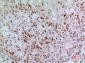 CD74 Polyclonal Antibody