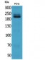 Integrin β4 Polyclonal Antibody