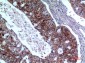 IL-1RII Polyclonal Antibody