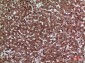 JAM-A Polyclonal Antibody