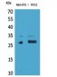 DcR1 Polyclonal Antibody