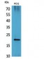 VEGF-B Polyclonal Antibody