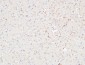 CRF-RI Polyclonal Antibody