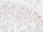 CRF-RI Polyclonal Antibody