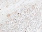 CRF-RI Polyclonal Antibody