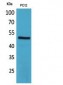 CRF-RI Polyclonal Antibody