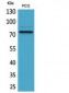 SAMHD1 Polyclonal Antibody