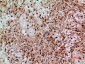 SAMHD1 Polyclonal Antibody