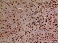 HMG-1 Polyclonal Antibody